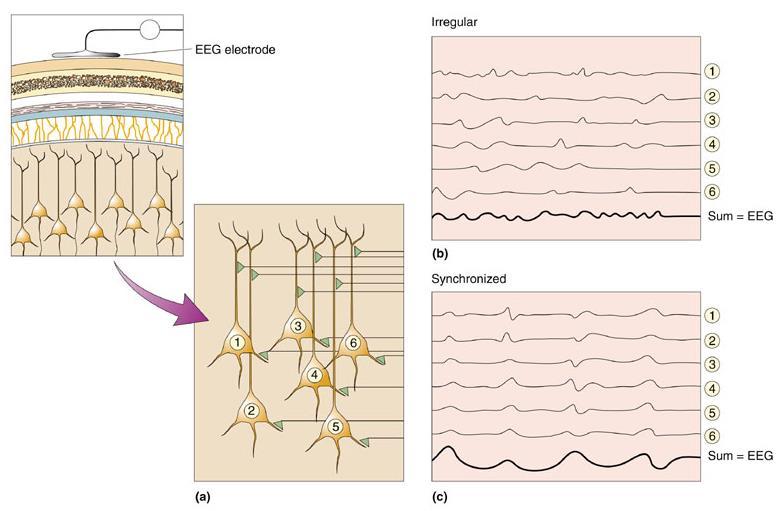 EEG Many neurons need to sum their activity in order to be detected by EEG electrodes.