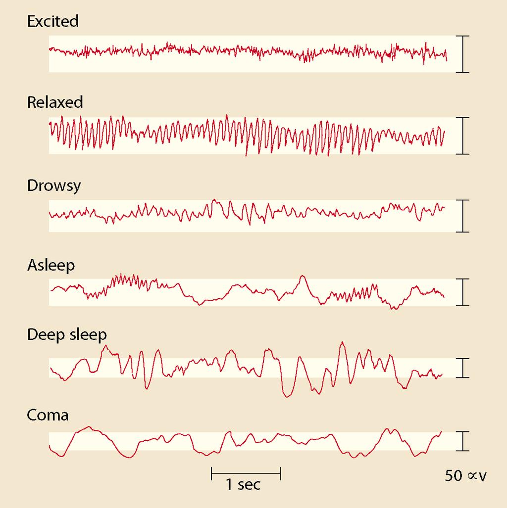 EEG EEG potentials are good indicators of global brain state.