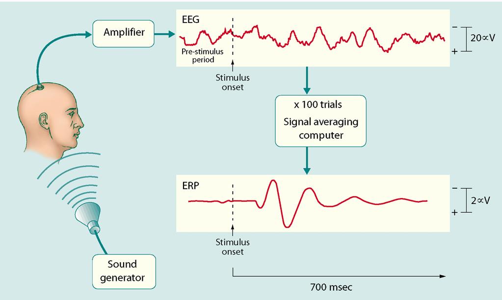 EEG - ERP ERP s are obtained after averaging EEG signals