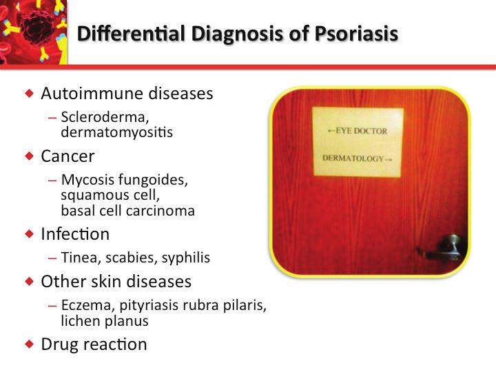 Differential Diagnosis of Psoriasis u Autoimmune diseases Subacute cutaneous lupus, dermatomyositis u Cancer Mycosis fungoides, squamous cell,