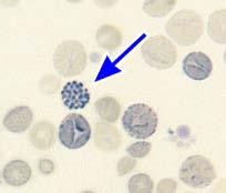 This precipitated hemoglobin inclusion can be observed when