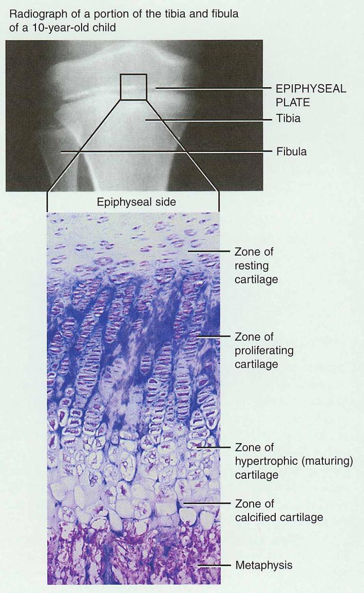 Bone Growth in Length Epiphyseal plate or cartilage growth plate (exists between primary and secondary ossification centers) Are bands of cartilage.