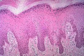 Meissner corpuscles:- are small encapsulated sensory receptors found in the dermis of skin (finger tip, foot, eyelid, lips) Meissner corpuscles are oval shape the receptors consist of delicate