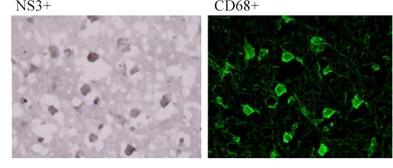 Cellular Localization Of Hcv Within The CNS: Microglia And Astrocytes 83-95% of HCV NS3+