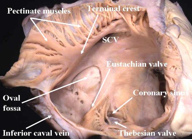 The posterior region of the right atrium have smooth LOOKING muscle, but the anterior portion has pectinate muscles