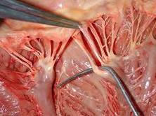 the papillary muscles tense the chordae tendineae, (heart
