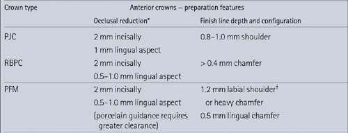 BALANCE: CONSERVING TOOTH STRUCTURE & AESTHETIC, STRONG CROWN BDJ,MAY 25 2002, VOLUME