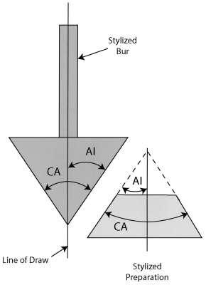 CA:convergence angle Total occlusal convergence of a preparation AI:axial inclination Angle of the preparation wall relative to the line of draw of the preparation