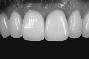 tooth structure Improve or
