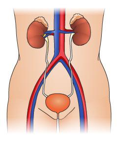 It discusses the anatomy of the urinary system, what to expect during CBI and risks and complications of the procedure.