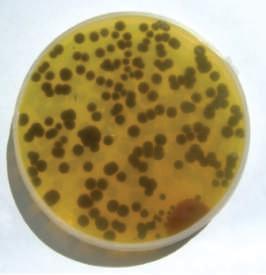 2 Fungi showing yellowing of bromophenol blue medium Fungal isolates were characterized by analyzing their shape and the structure of colonies, presence of amylase and