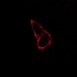 Confocal images of HeLa cells stained with TTVP for different time.