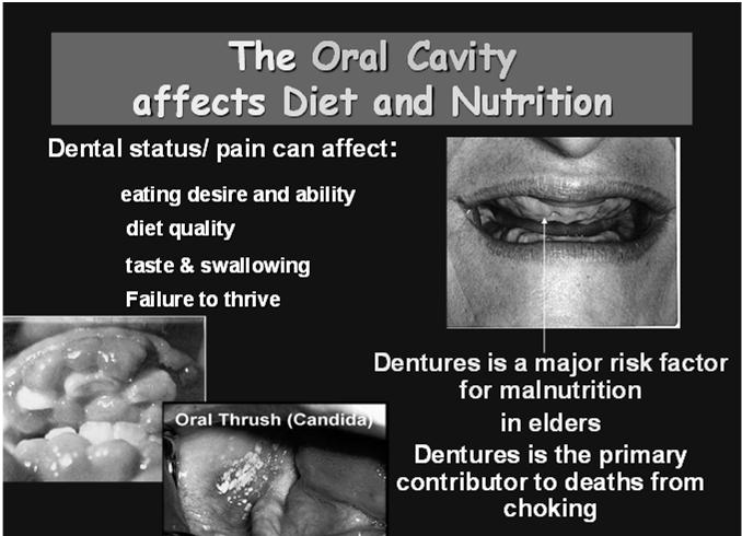 loss How Diet Effects Teeth: (Like politics: all