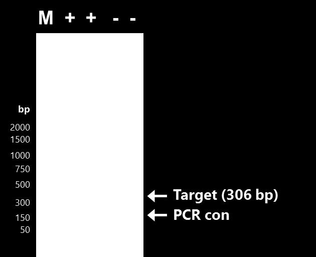 Figure 1: A representative 1X TAE, 1.4 % agarose gel showing the amplification of CMV at different concentrations.