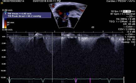 a meta analysis. Cardiovascular ultrasound 2015, 13:37.