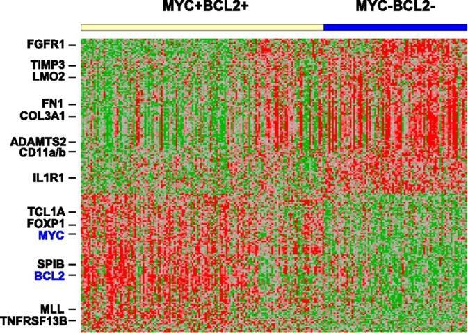 DLBCL WITH MYC/BCL2 CO-EXPRESSION (2013) THIS SHOWS A DISTINCT GENE