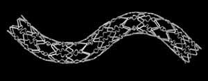 Case Study 13 What is the risk classification of a cardiovascular stent?