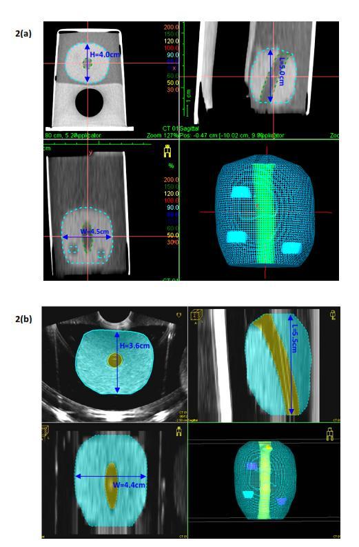 As we mimic the TRUS images as CT images, it is very important that integrity and accuracy of the image information is not compromised during image format conversion.