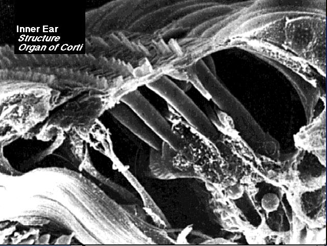 Organ of corti Here s a electron micrograph Three rows of outer hair cells are