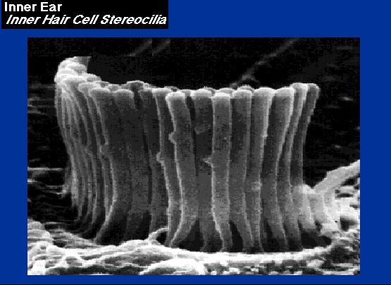 electron micrograph of the top of a single inner hair cell The cilia pivot on their