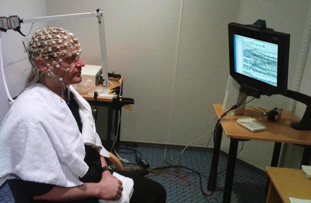 Electroencephalogram (EEG) In an EEG, electrodes are placed on the skull.