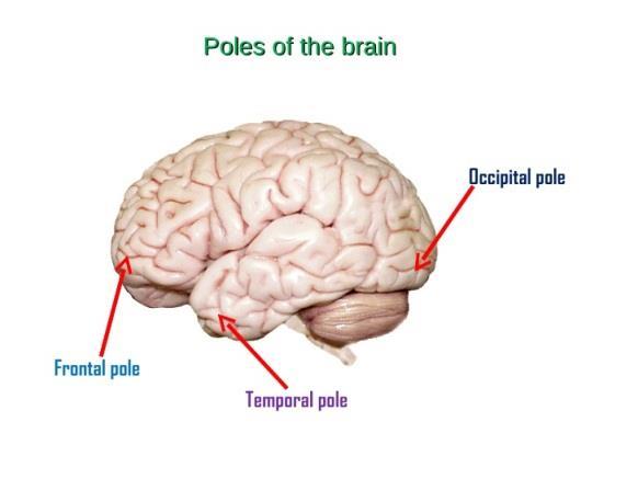 (Rhombencephalon): consists of the pons, medulla and cerebellum The Cerebral Hemisphere: -The cerebrum consists of 3 poles: 1) Frontal pole: Supero-anteriorly (rounded) 2) Temporal pole: