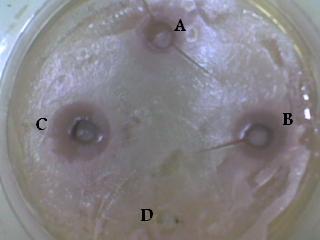 infectoria on Candida albicans in vitro at differents concentration. Fig. (20) Fig.