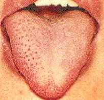 back of tongue likely to be normal no worries