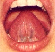 the tongue If they are longer, look for other varicosities,