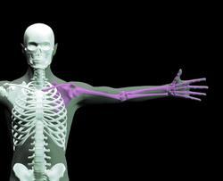 UPPER EXTREMITY INJURIES Recognizing