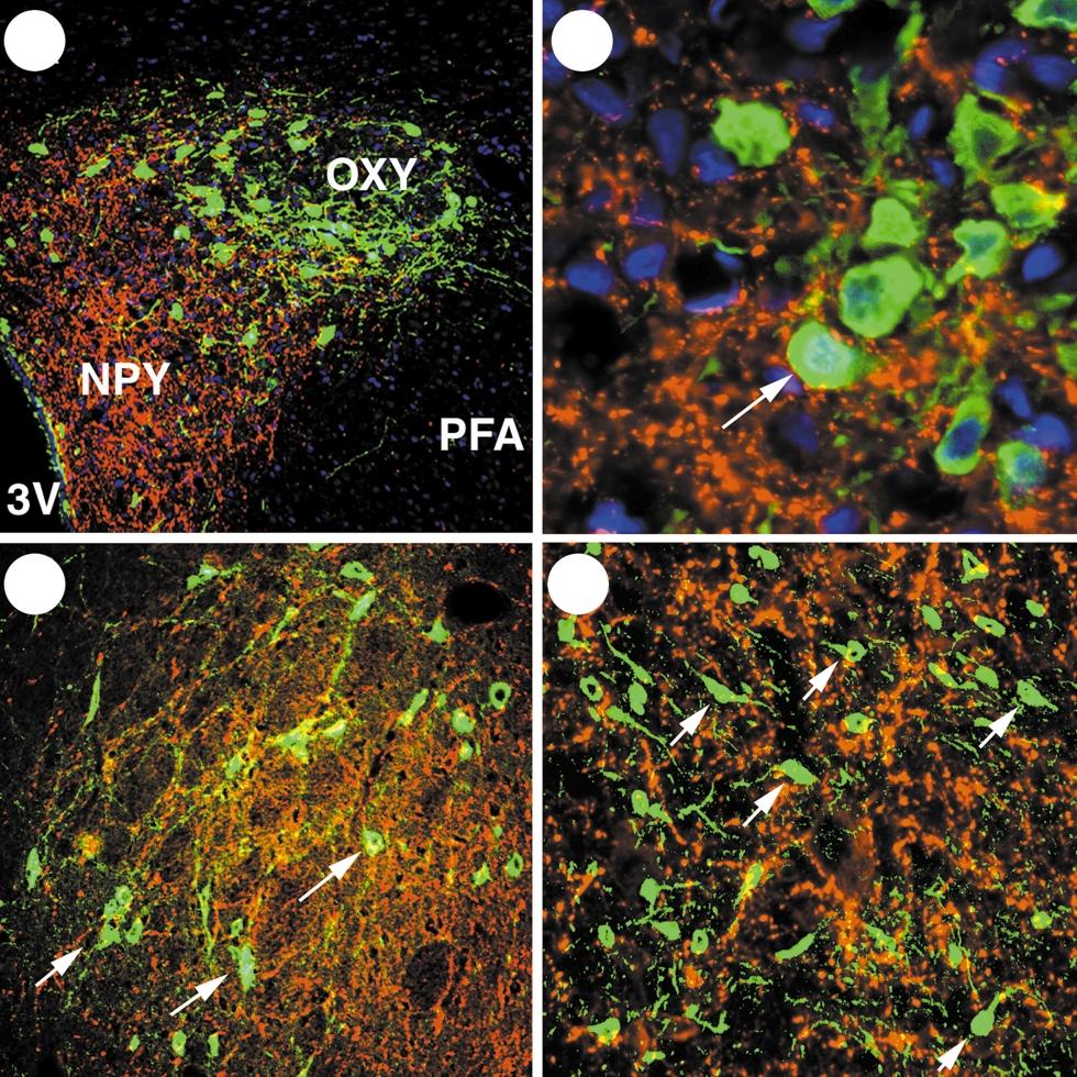 d, PFA showing NPY-containing axons (red fluorescence) surrounding neuron cell bodies containing orexins (green fluorescence).