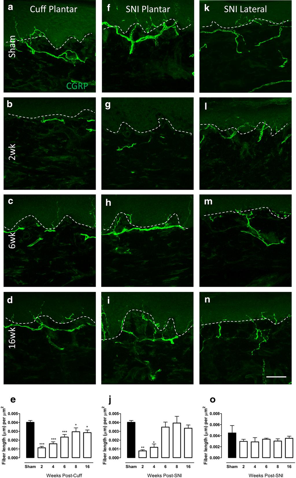 Nascimento et al. Mol Pain (2015) 11:59 Page 5 of 14 Fig. 3 Changes in CGRP-IR fibre innervation in the upper dermis of the paw skin of cuff and SNI rats.