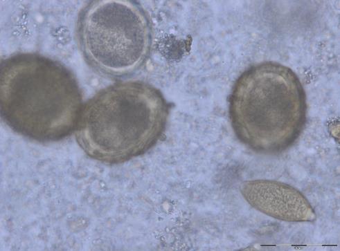 lumbricoides eggs in