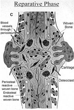 Proliferation of fibroblasts and osteoblasts Invasion of