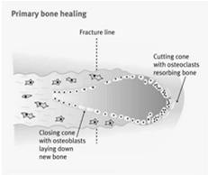 Process of continuous bone resorption and formation Bone is