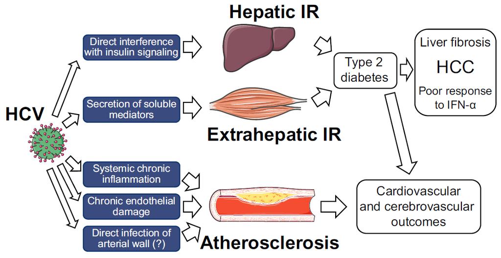 HCV, Cardiovascular and Metabolic Events: Possible Mechanisms IR, insulin-resistance; HCC, hepatocellular