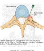 - Vertebrae 11-12 : (sry couldn t find picture for them ) A) their bodies contain only one facet WHY?