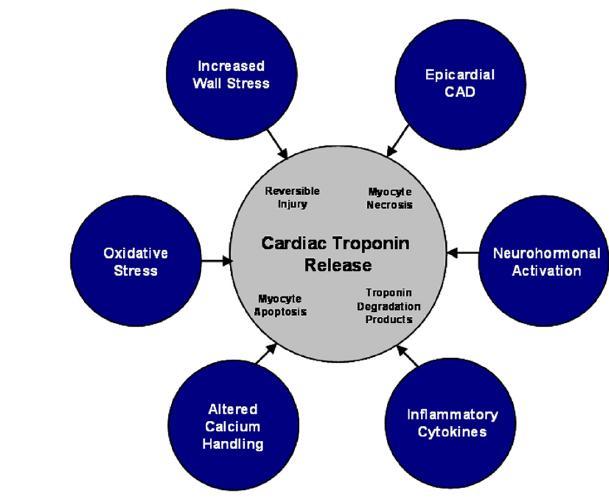 Mechanisms of Cardiac