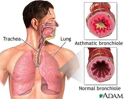 Specific Respiratory Conditions Chronic
