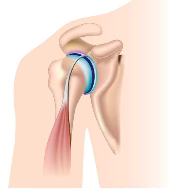Joints of the upper limb The shoulder joint Humeral head (ball) The shallow socket allows for a great deal of movement Humerus Glenoid (socket) Scapula The scapula and the humerus Synovial ball and