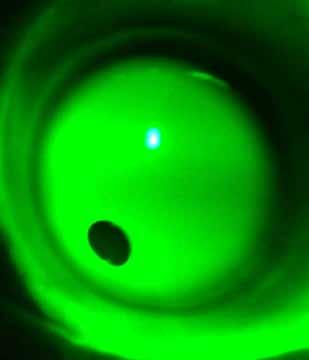 Troubleshooting & Tips for Success Bubbles Because air bubbles can affect the appearance of the fluorescein pattern, it is critical to eliminate them prior to evaluating the fit.