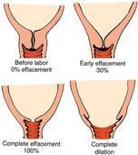 Labor Functions of the female reproductive Dilation stage The uterine smooth muscle begins to contract system Contractions move the fetus down the uterus and
