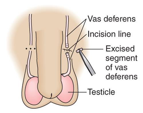 Reproductive process: male contraception Abstinence