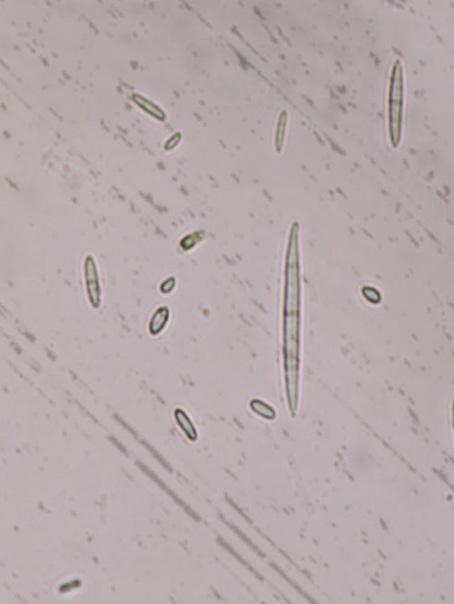 stressful environmental conditions, chlamydospores are formed from the aforementioned pathogen structures.