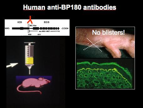 Demonstration of pathogenic activity of anti-bp180 auto-antibodies in murine models: previous limitations Human anti-bp180 auto-abs fail to react with mouse BP180 and do