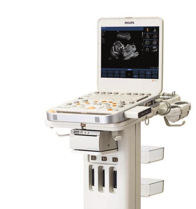 Philips CX50 CompactXtreme ultrasound system Now you can be confident in the data from your portable exams, including your most technically challenging studies.