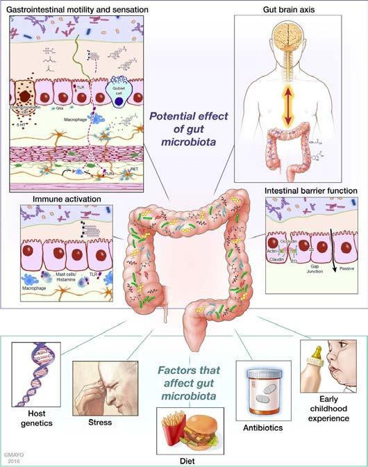 Microbiome and gut comfort Altered microbiota associated with perturbed gut function, including irritable bowel syndrome (IBS)