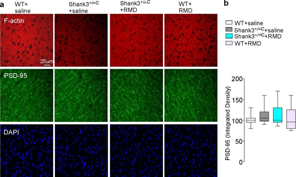 Supplementary Figure 6 Romidepsin treatment restores actin filaments in PFC of Shank3-deficient mice.
