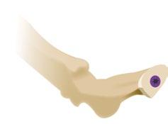 middle phalanx base, perpendicular to longitudinal axis of those bones.