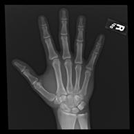 25 HAND AND WRIST RADIOGRAPHS 26 THE WATSON OR